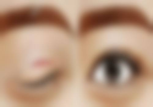 六、海口栩栩美医疗美容门诊部价格表