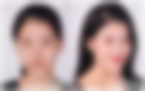 六、后续保护与跟踪服务