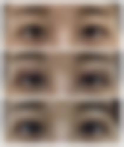 四、湘潭爱尔仁和医疗美容特色项目