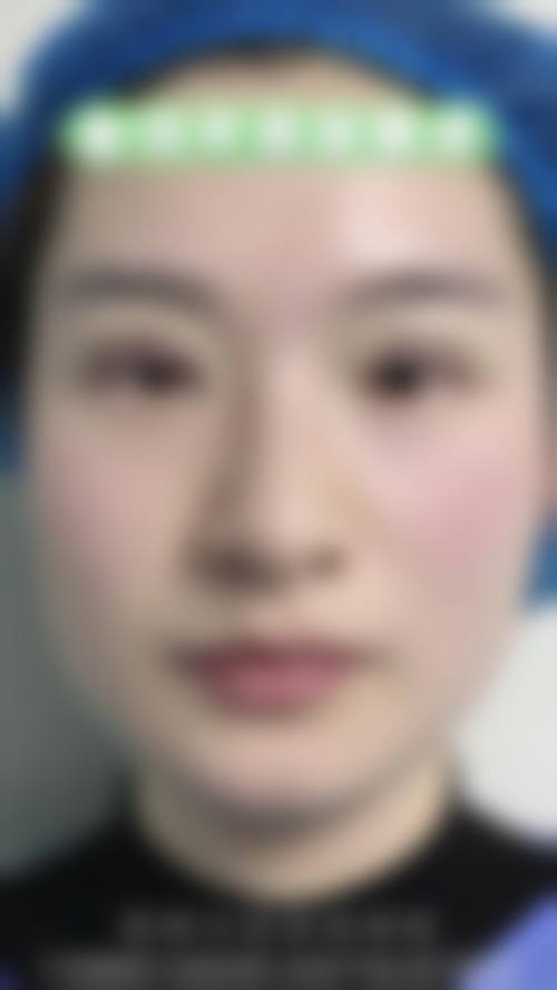 七、汕头奥拉克医疗美容诊所预约方式