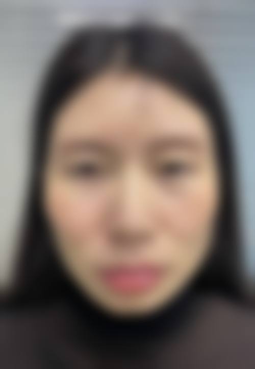 二、深圳暨南大学附属深圳华侨医院整形科怎么样？