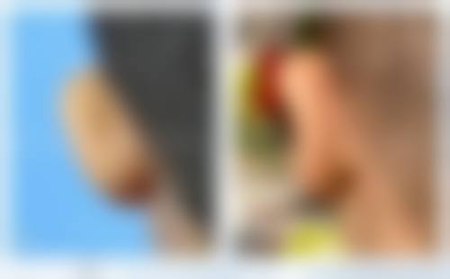 九、泰山药物研究所卫生所整形科真实的患者评价