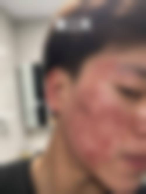 三、烟台华韩（原韩秀）整形医院诊疗项目有哪些？