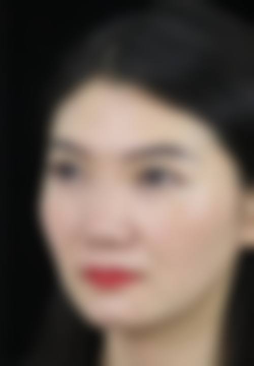 八、德克莱斯整形外科真实的患者评价