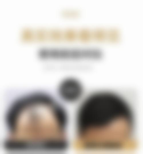 四、烟台华韩（原韩秀）整形医院特色项目