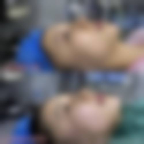 四、襄阳新艾伊尔医疗美容诊所特色项目