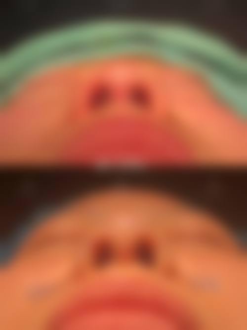 八、韩国kowon整形外科预约方式