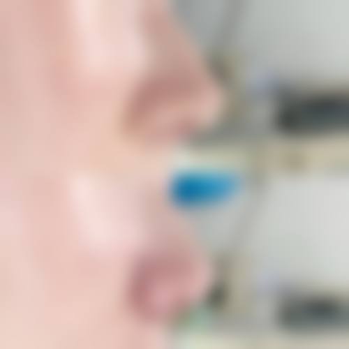 九、唐山工人医院整形美容外科真实的患者评价