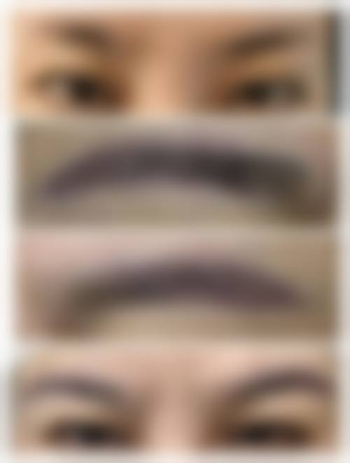 八、韩国bonna_aesthe皮肤科真实的患者评价