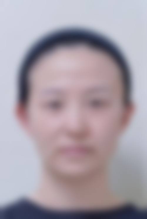 八、四川内江百龄京菊整形真实的患者评价