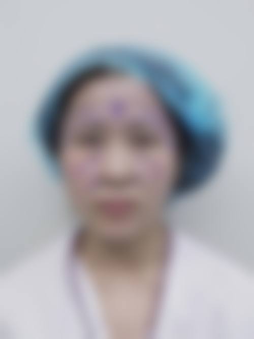 八、汕头奥拉克医疗美容诊所真实的患者评价