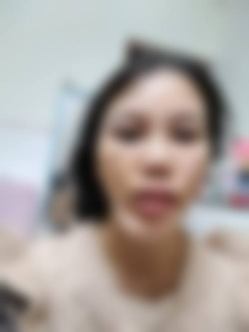 八、烟台华韩（原韩秀）整形医院真实的患者评价