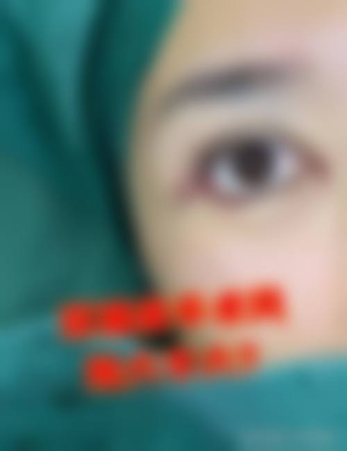 八、成都高新柏宇医疗美容诊所真实的患者评价