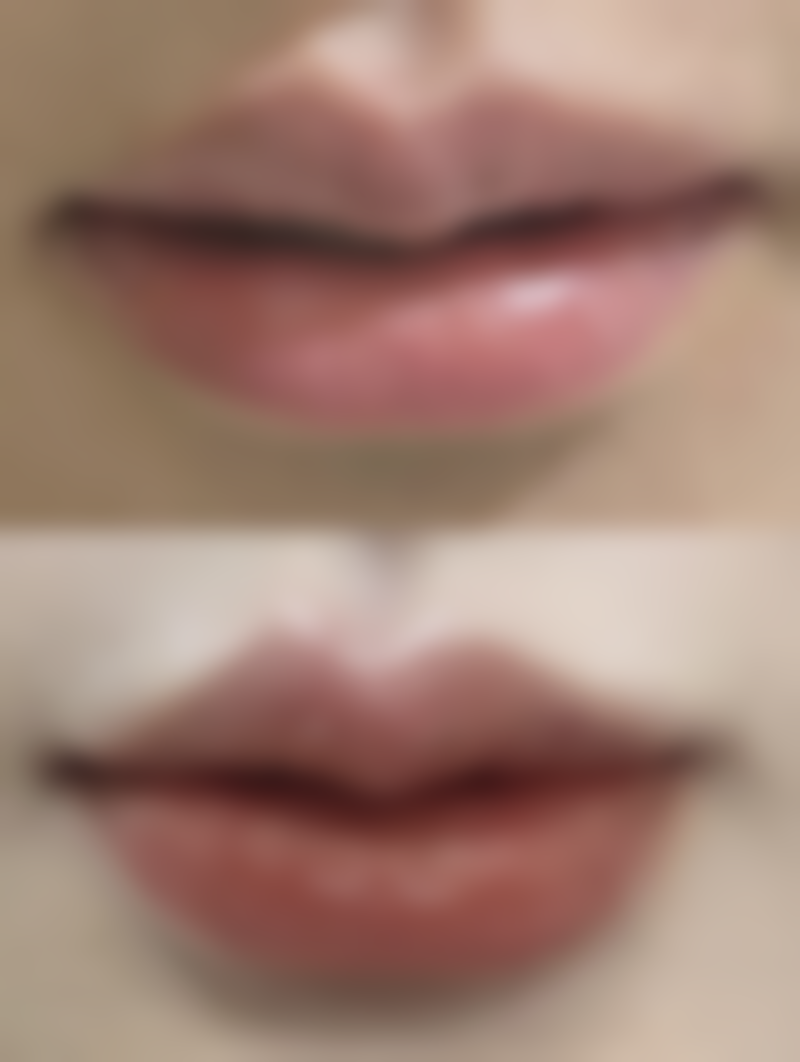 五、汕头奥拉克医疗美容诊所价格表