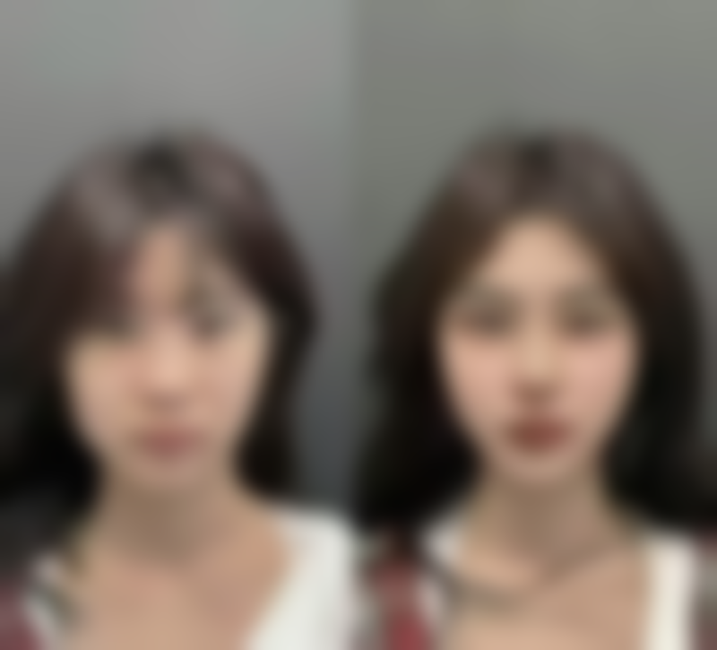 九、长沙你美医疗美容门诊部真实的患者评价