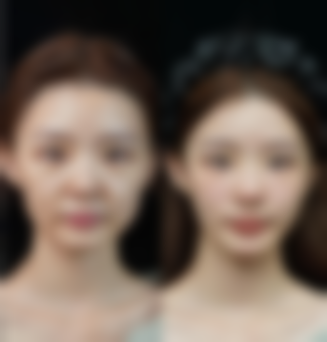 {宜宾宜美整形医院冷冻减脂项目仅需3000元，个性化方案塑造完美身材 