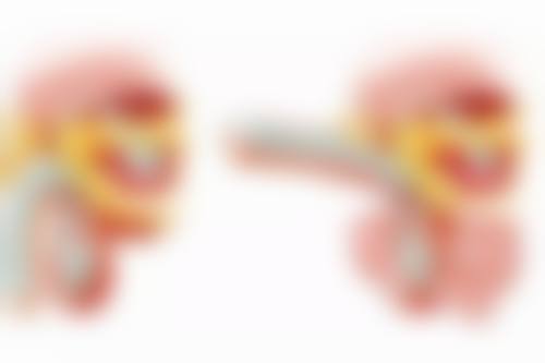 四、瘦脸针应该了解的成效维持时长