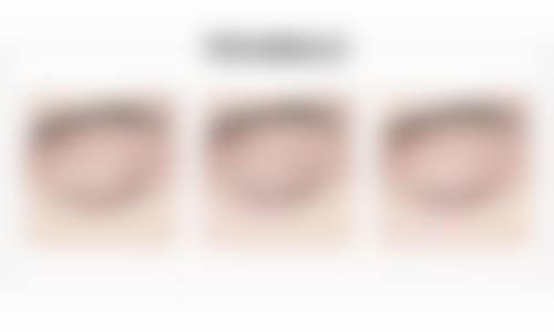 二、临沂瑞丽整形美容医院怎么样?