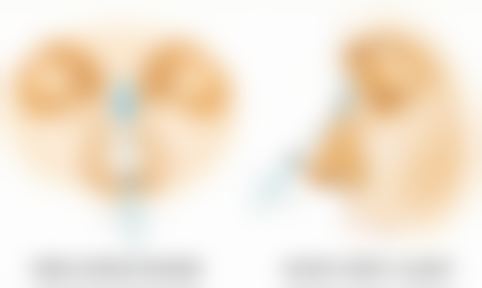 三、日常护理建议