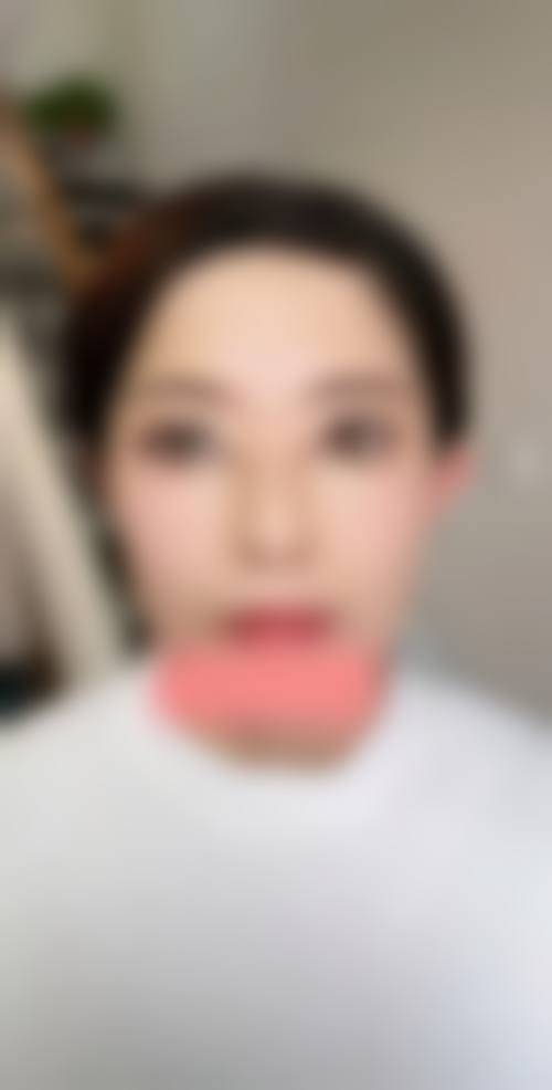 六、临沂瑞丽整形美容医院价格表