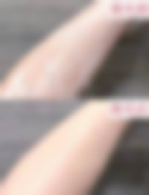 四、大连市中 心医院医学美容科特色项目