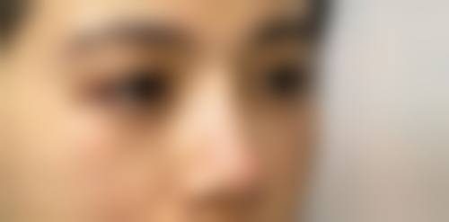 六、成都悦颜医疗美容门诊部价格表