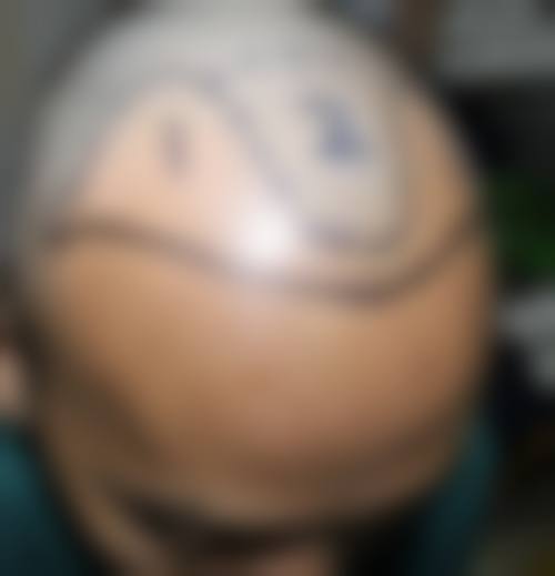 四、荆州青逸美植发医疗美容门诊特色项目