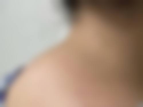 六、昭通市中医医院皮肤美容科地址及交通