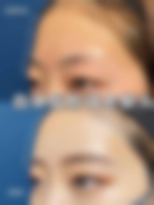 五、TCB 中央美容外科仙台广濑通价格表