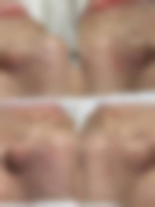 九、厦门姮美整形美容中 心真实的患者评价