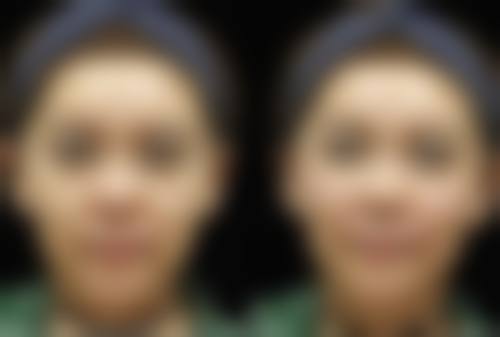 九、成都武侯润颜德玛整形医院真实的患者评价