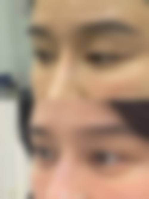 八、淮北禾一医疗美容门诊部真实的患者评价