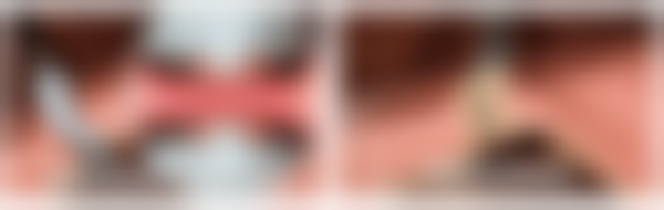 四、韩国MD整形医院特色项目