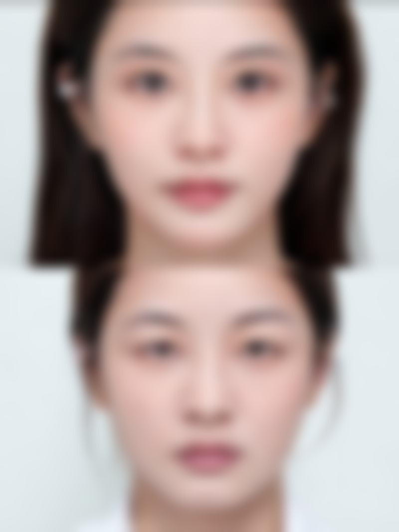 七、现在流行什么样的双眼皮好看的总结