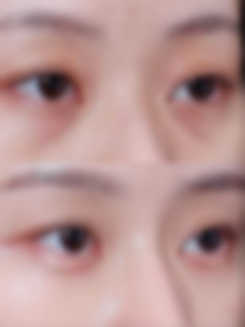 二、常见治疗方法