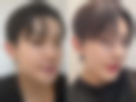 一、征兵体检对疤痕的总体考量因素