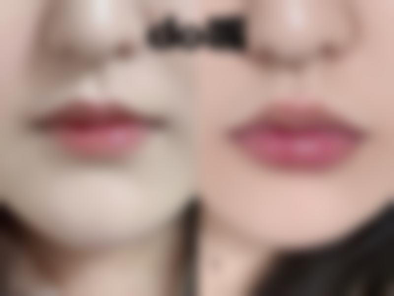 六、泉州石狮柏丽整形美容医院价格表