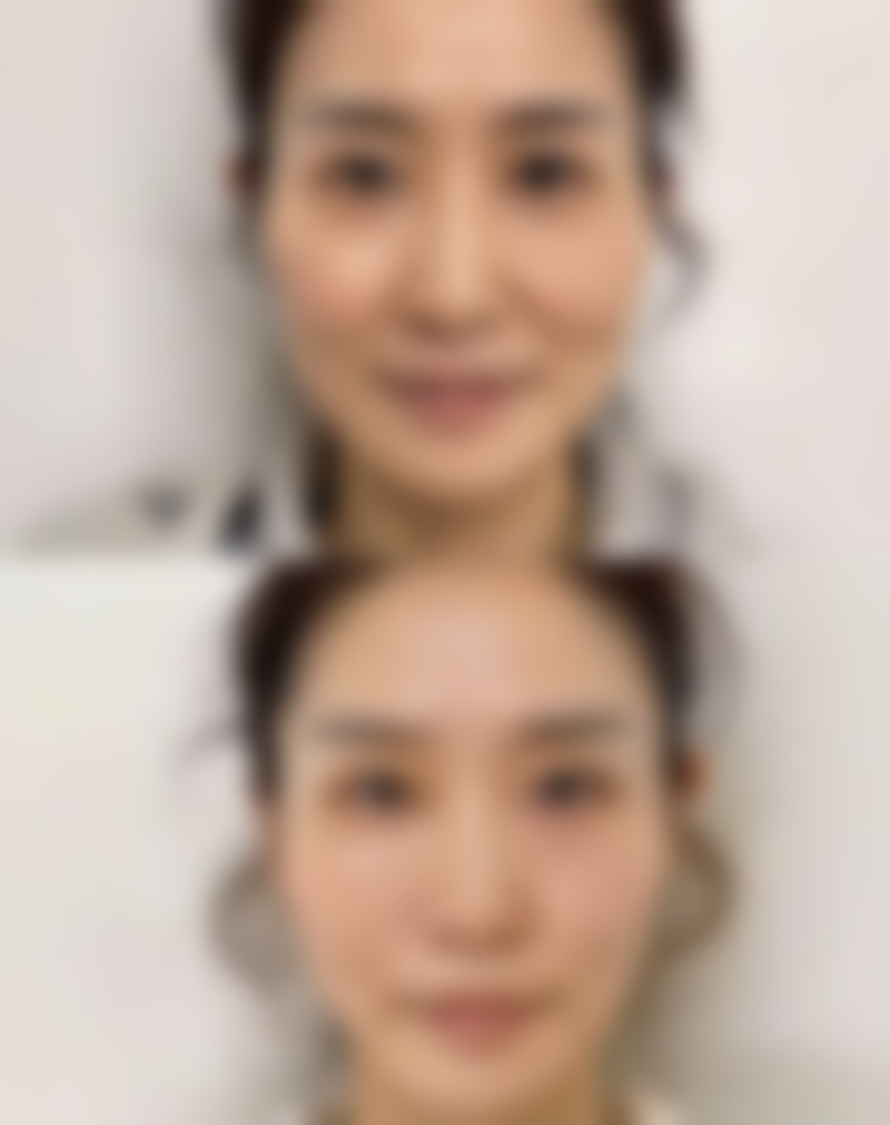 六、选择适合自己双眼皮的要点