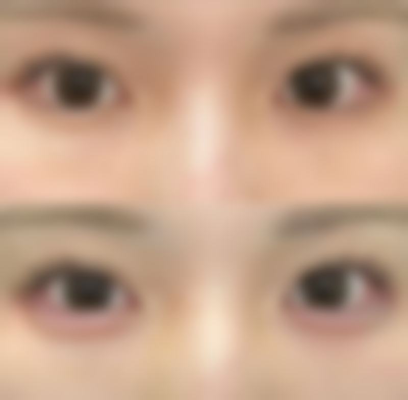 四、针对性解决方案