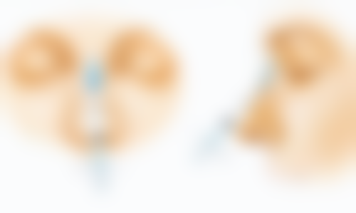 一、割双眼皮年纪大了眼部可能出现的变化