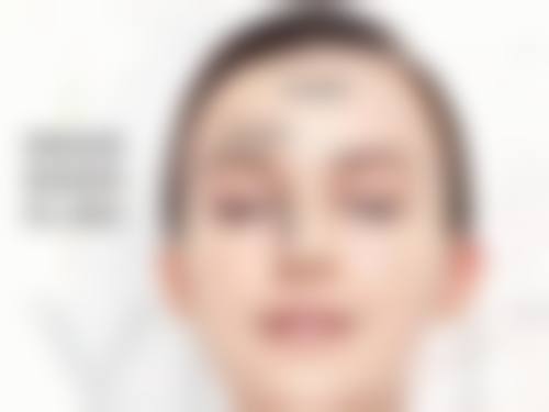 二、眼袋有真假之分