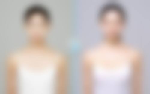 六、淮北天使整形医院价格表