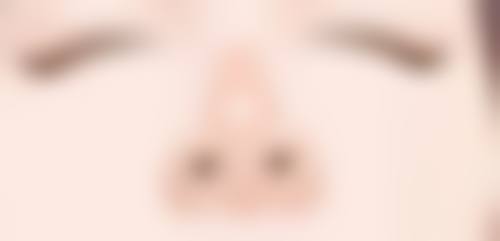 三、非手术方案适用情况