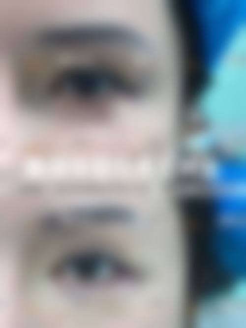 二、长春领美整形医院怎么样？