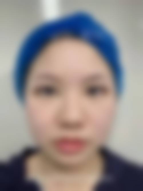 八、汕头曙光医疗美容真实的患者评价