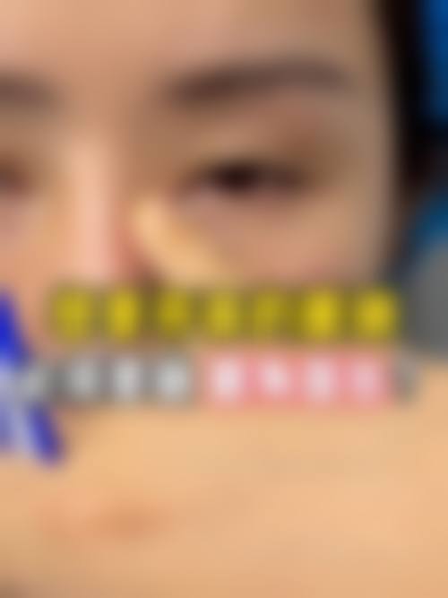 四、淮北天使整形医院特色项目