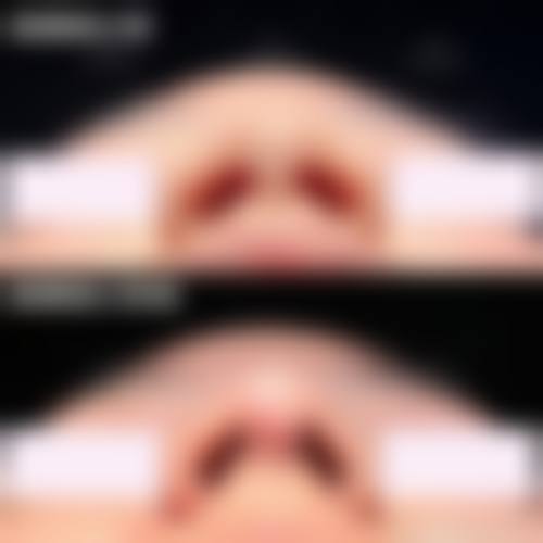 三、郑州安琪儿医疗美容门诊诊疗项目有哪些?