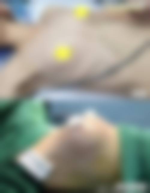 九、牡丹江市亮颜整形医疗美容门诊部真实的患者评价