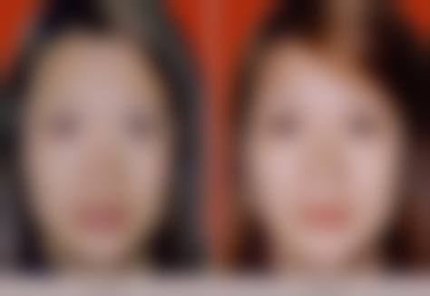 九、长春领美整形医院真实的患者评价