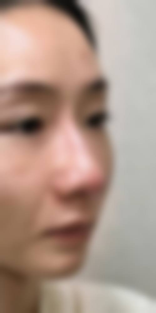 八、北海美秀中禾整形美容医院真实的患者评价